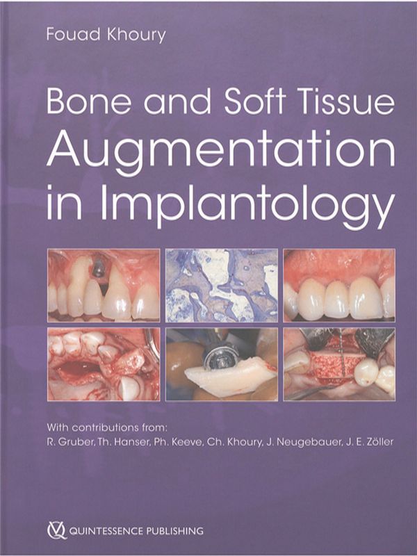 Bone and soft tissue augmentation in implantology