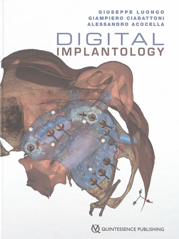 Digital implantology