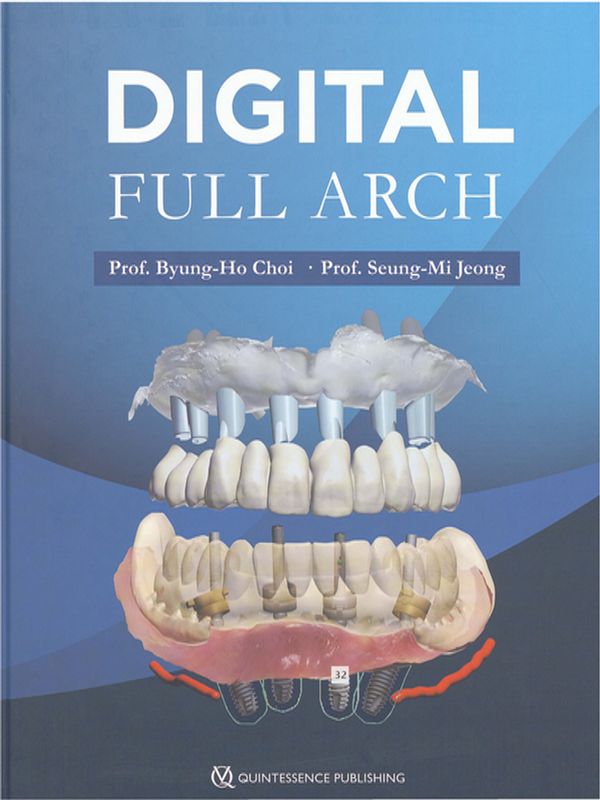 Digital full arch