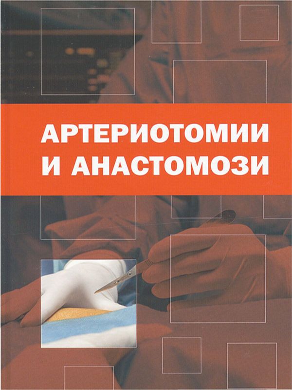 Артериотомии и анастомози