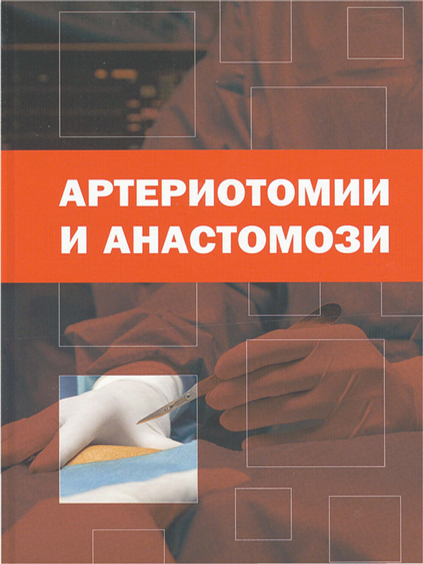 Артериотомии и анастомози