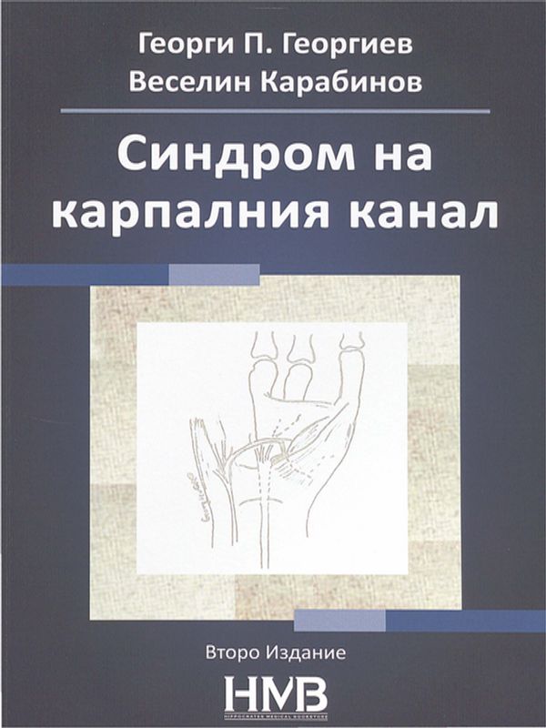 Синдром на карпалния канал