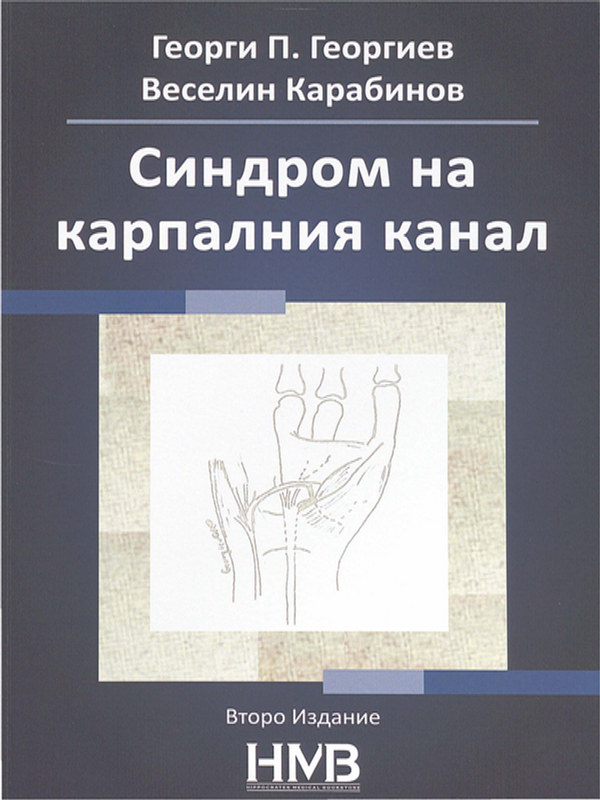 Синдром на карпалния канал