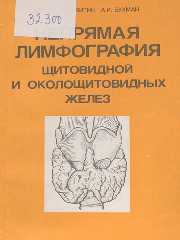 Непрямая лимфография щитовидной и околощитовидных желез
