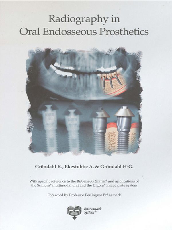 Radiography in oral endosseous prosthetics