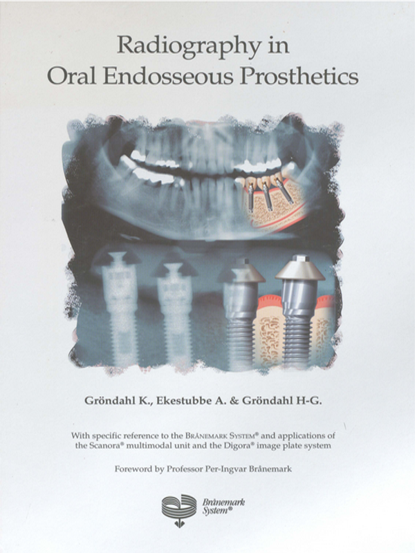 Radiography in oral endosseous prosthetics