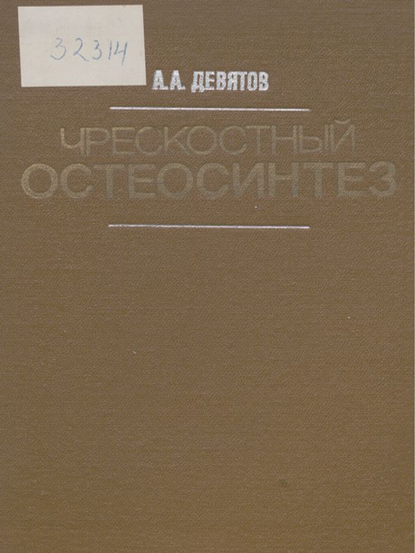 Чрескостный остеосинтез