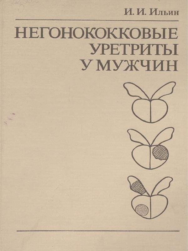 Негонококковые уретриты у мужчин