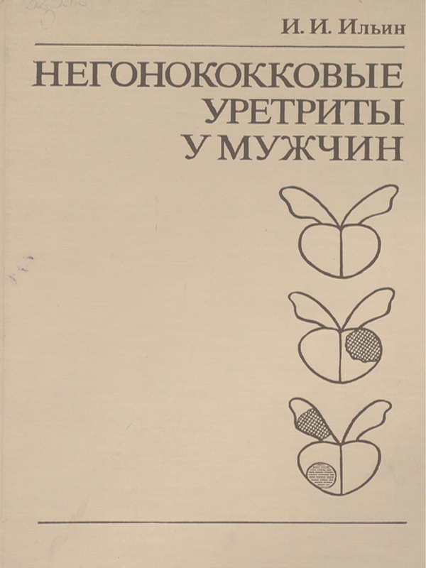 Негонококковые уретриты у мужчин