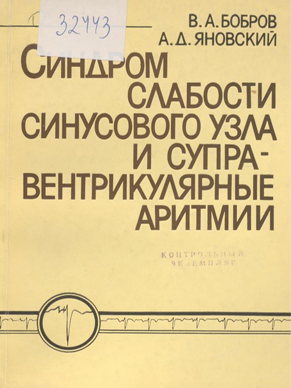 Синдром слабости синусового узла в клинике суправентрикулярных аритмий