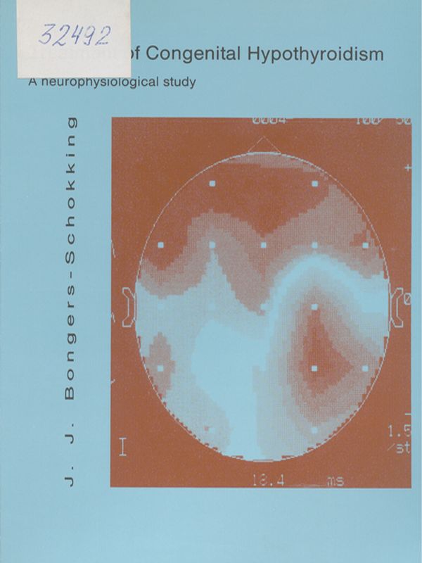 Treatment of congenital hypothyroidism