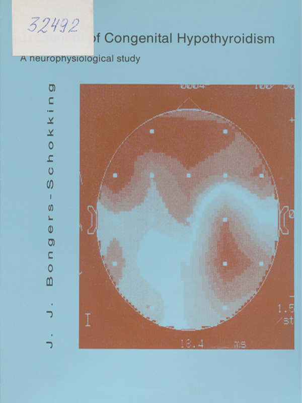 Treatment of congenital hypothyroidism