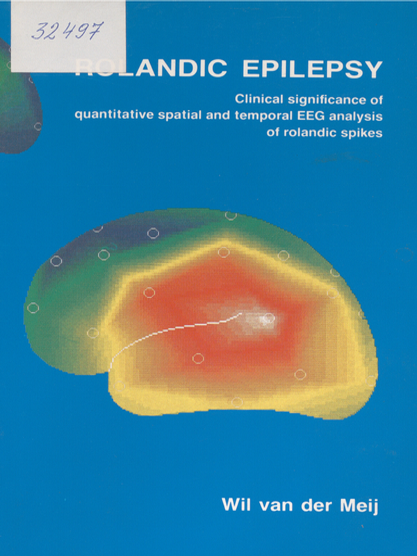 Rolandic epilepsy