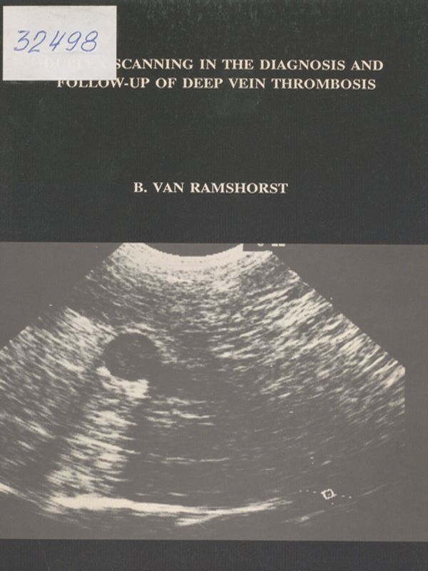 Duplex scanning in the diagnosis and follow-up of deep vein thrombosis