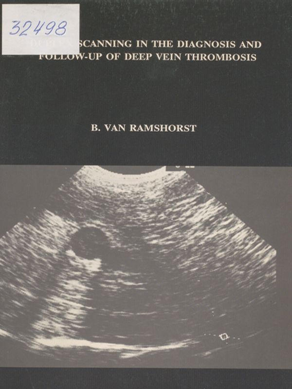 Duplex scanning in the diagnosis and follow-up of deep vein thrombosis