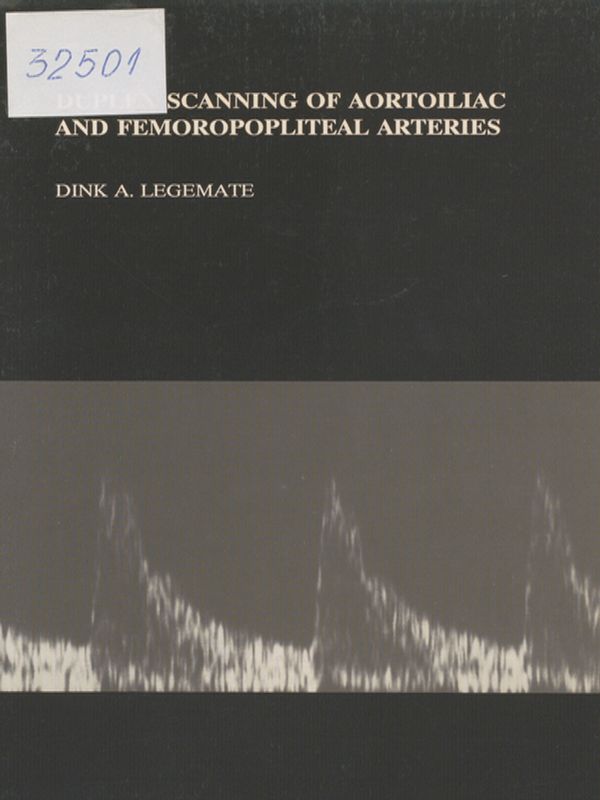 Duplex scanning of aortoiliac and femoropopliteal arteries