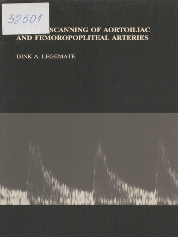 Duplex scanning of aortoiliac and femoropopliteal arteries