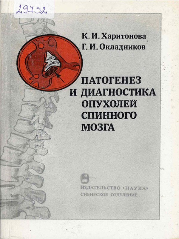 Патогенез и диагностика опухолей спинного мозга