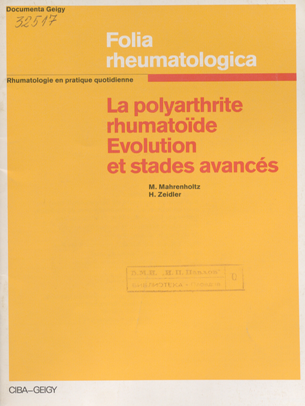 La polyarthrite rhumatoide : Evolution et stades avances