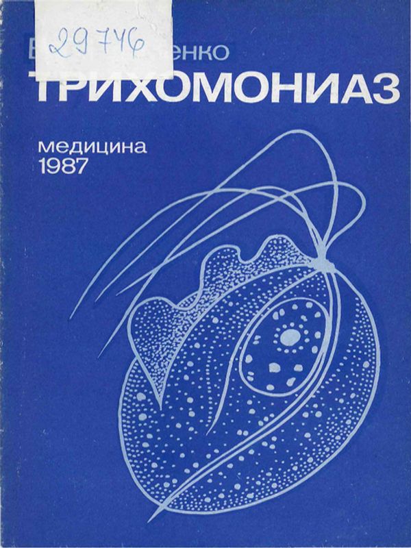 Трихомониаз