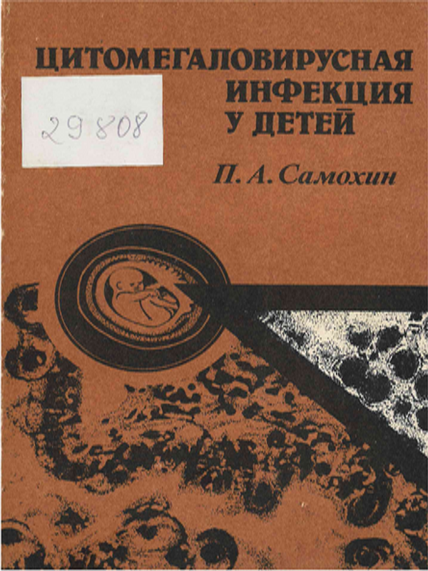 Цитомегаловирусная инфекция у детей