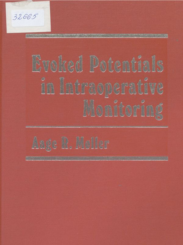 Evoked potentials in intraoperative monitoring