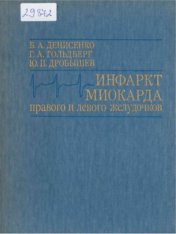 Инфаркт миокарда правого и левого желудочков
