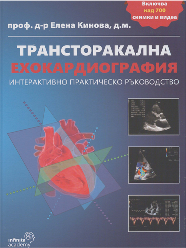 Трансторакална ехокардиография