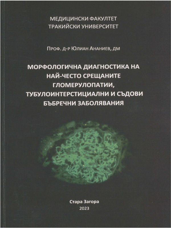 Морфологична диагностика на най-често срещаните гломерулопатии, тубулоинтерстициални и съдови бъбречни заболявания