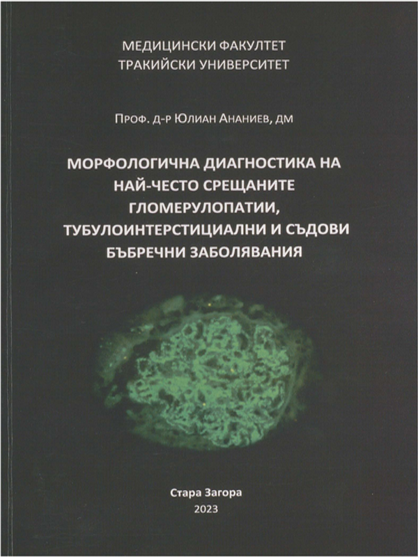 Морфологична диагностика на най-често срещаните гломерулопатии, тубулоинтерстициални и съдови бъбречни заболявания