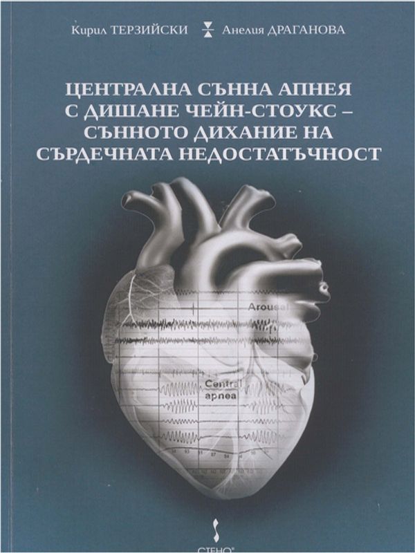 Централна сънна апнея с дишане Чейн-Стоукс - сънното дихание на сърдечната недостатъчност