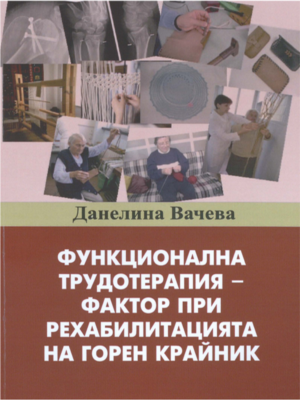 Функционална трудотерапия - фактор при рехабилитацията на горен крайник
