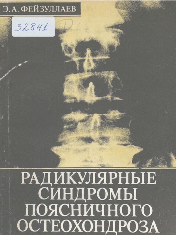 Радикулярные синдромы поясничного остеохондроза