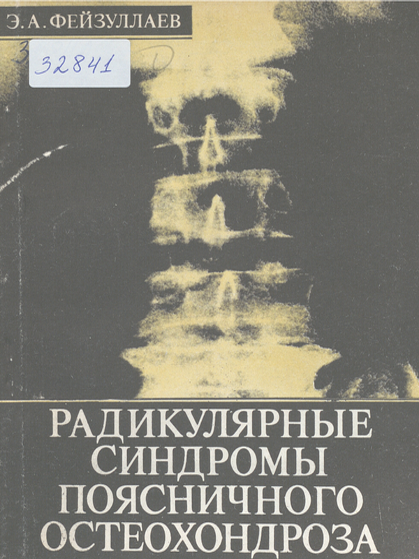 Радикулярные синдромы поясничного остеохондроза
