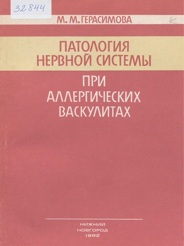Патология нервной системы при аллергических васкулитах