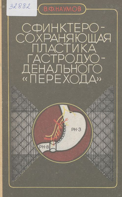 Сфинктеросохраняющая пластика гастродуоденального : Перехода