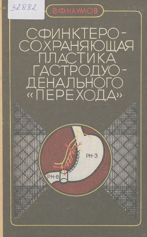 Сфинктеросохраняющая пластика гастродуоденального : Перехода