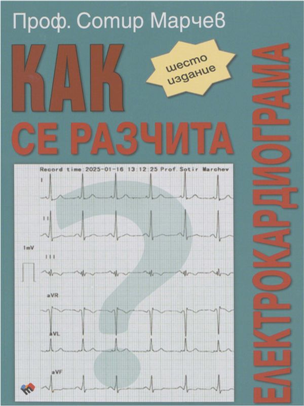 Как се разчита електрокардиограма