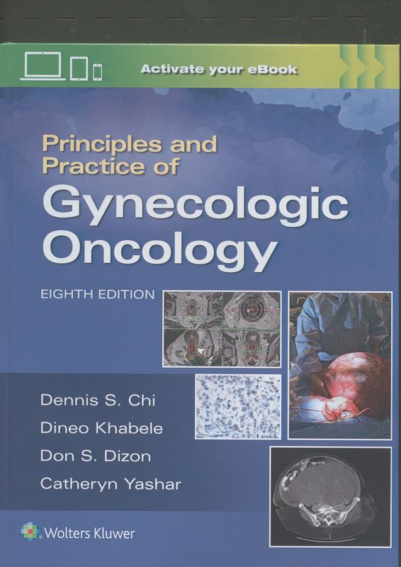 Principles and practice of gynecologic oncology