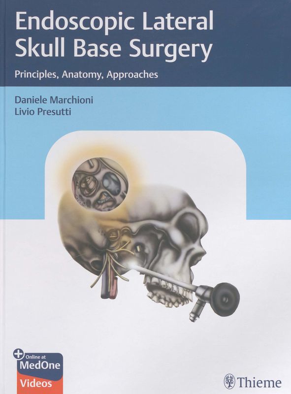 Endoscopic lateral skull base surgery