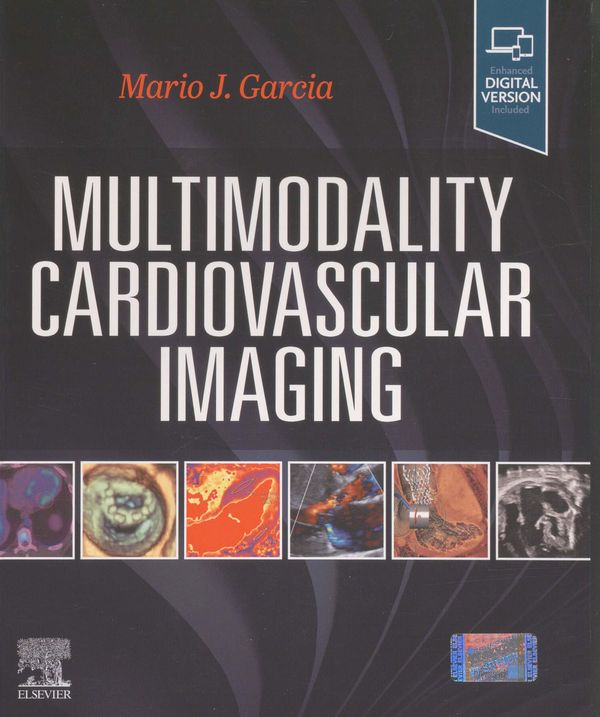 Multimodality cardiovascular imaging