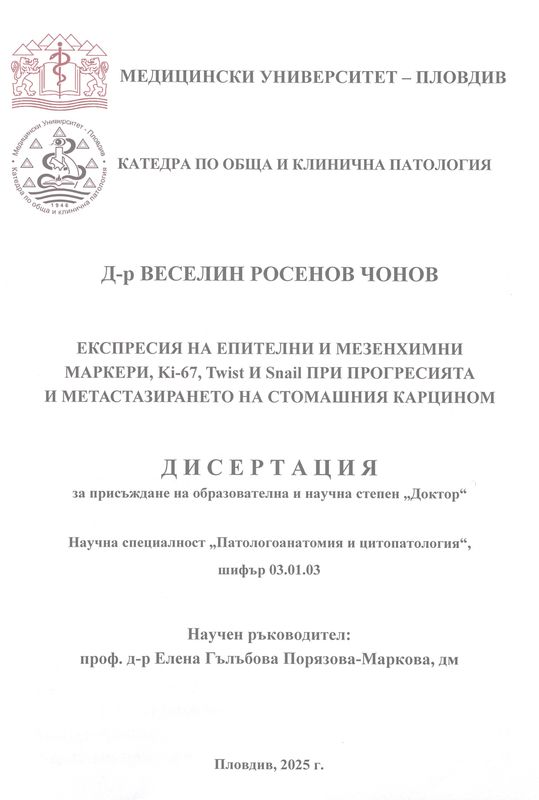 Експресия на епителни и мезенхимни маркери, Ki-67, Twist и Snail при прогресията и метастазирането на стомашния карцином