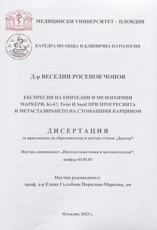 Експресия на епителни и мезенхимни маркери, Ki-67, Twist и Snail при прогресията и метастазирането на стомашния карцином