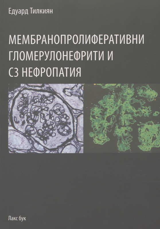 Мембранопролиферативни гломерулонефрити и С3 нефропатия