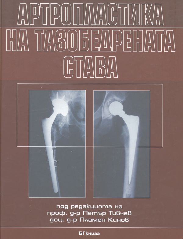 Артропластика на тазобедрената става