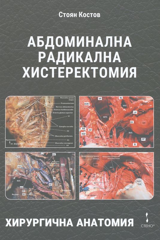 Абдоминална радикална хистеректомия