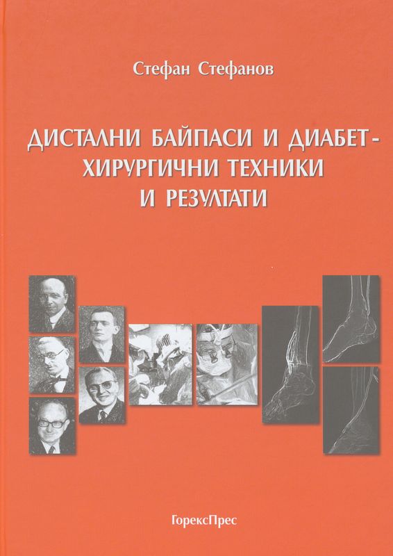 Дистални байпаси и диабет - хирургични техники и резултати