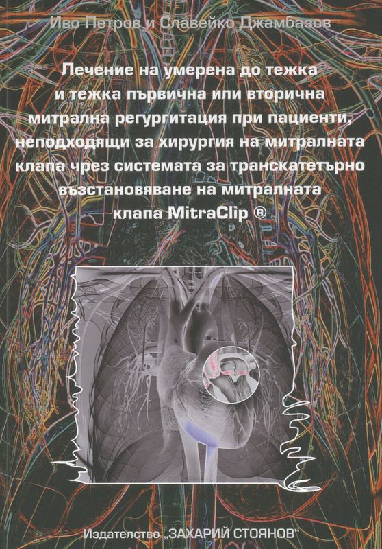Лечение на умерена до тежка и тежка първична или вторична митрална регургитация при пациенти, неподходящи за хирургия на митралната клапа чрез системата за транскатетърно възстановяване на митралната клапа MitraClip