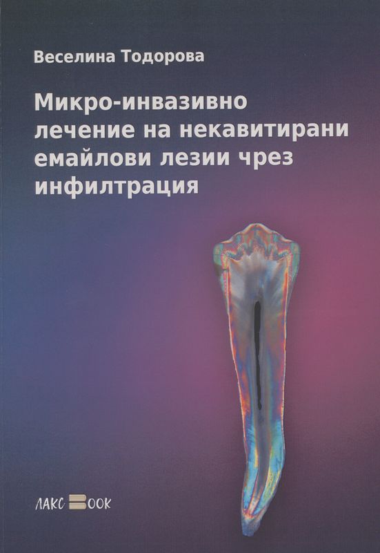 Микро-инвазивно лечение на некавитирани емайлови лезии чрез инфилтрация