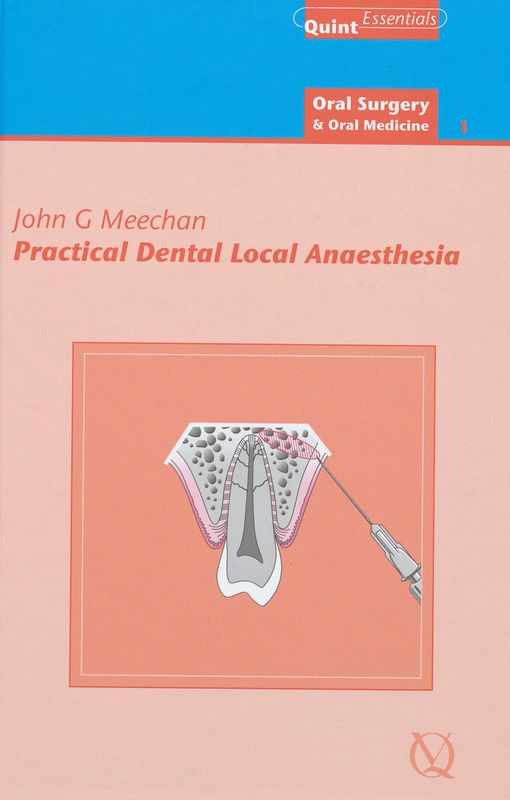 Practical dental local anaesthesia
